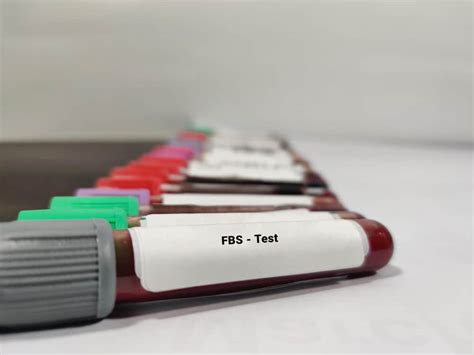 fbs in medical terms|Everything On Fasting Blood Sugar Test (FBS Test) .
